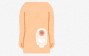 中井美穂さん、がん治療による人工肛門生活を告白